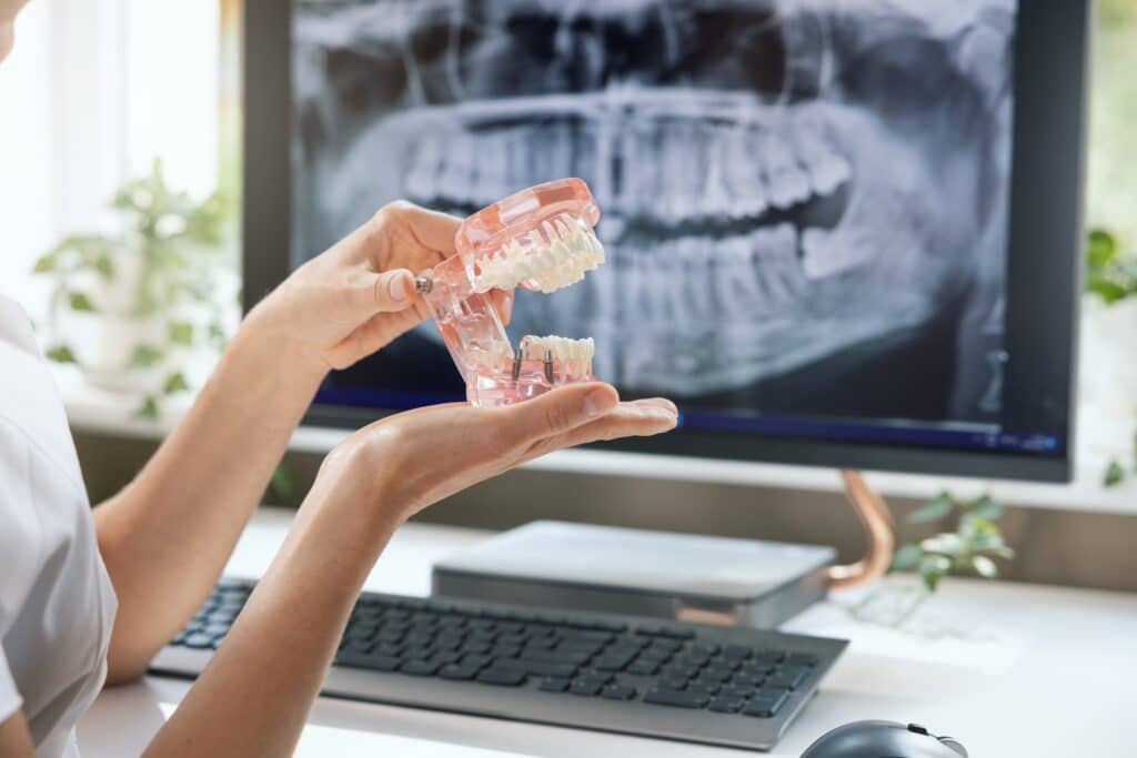 Dentist,Implantologist,Showing,Teeth,Model,With,Implant,Screw,Sample,In